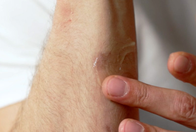 A New Solution for Revitalized Skin